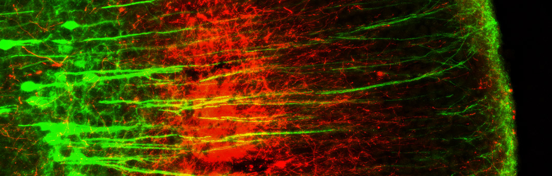 Research Area 1: Impact of Chronic Stress on Mouse Neural Circuits and Behavior